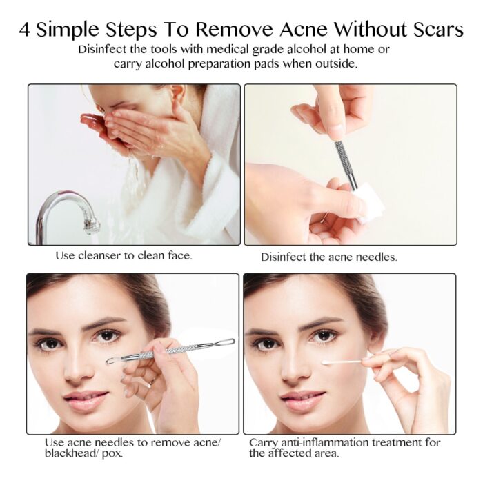 4pcs blackhead remover tool acne needle blemish pimple spot blackhead extractor remover tool pore cleaner face cleansing tools